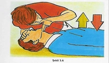 Solunum Yolu Tıkanması Belirtileri ve Tedavisi Solunum Yolu Tıkanması Belirtileri ve Tedavisi